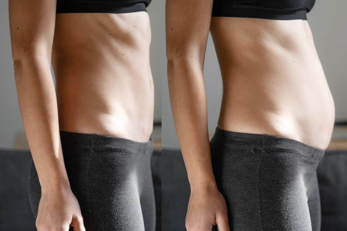 How long does diastasis recti take to improve Northampton?