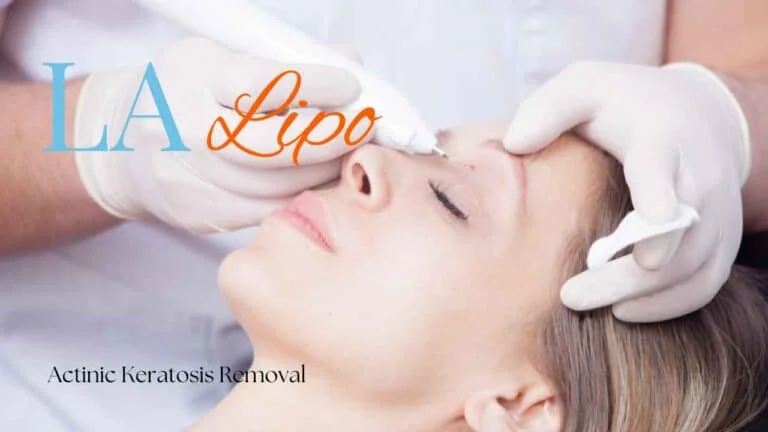 Woman receiving Actinic Keratosis Removal Treatment Northampton