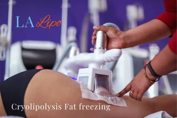 women getting fat freezing Northampton
