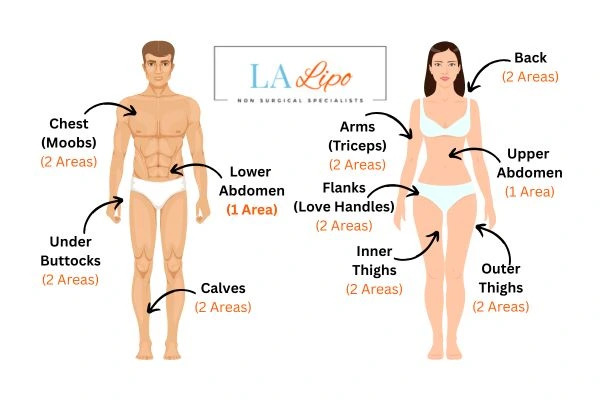 LA LIPO Cryolipolysis Areas Northampton