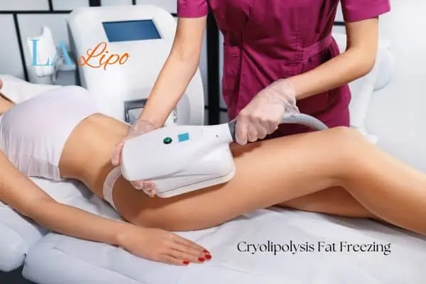 Woman receiving coolsculpting Northampton treatment on her thighs