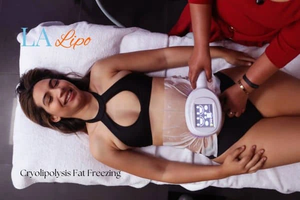 woman getting cryolipolysis Northampton