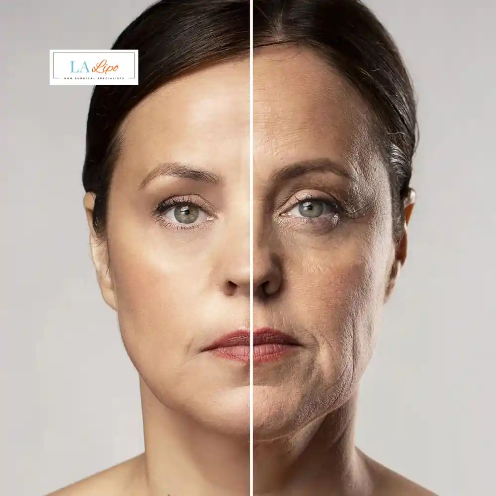 How Can You Tell If Non-Surgical Skin Tightening Is Right for You Northampton?