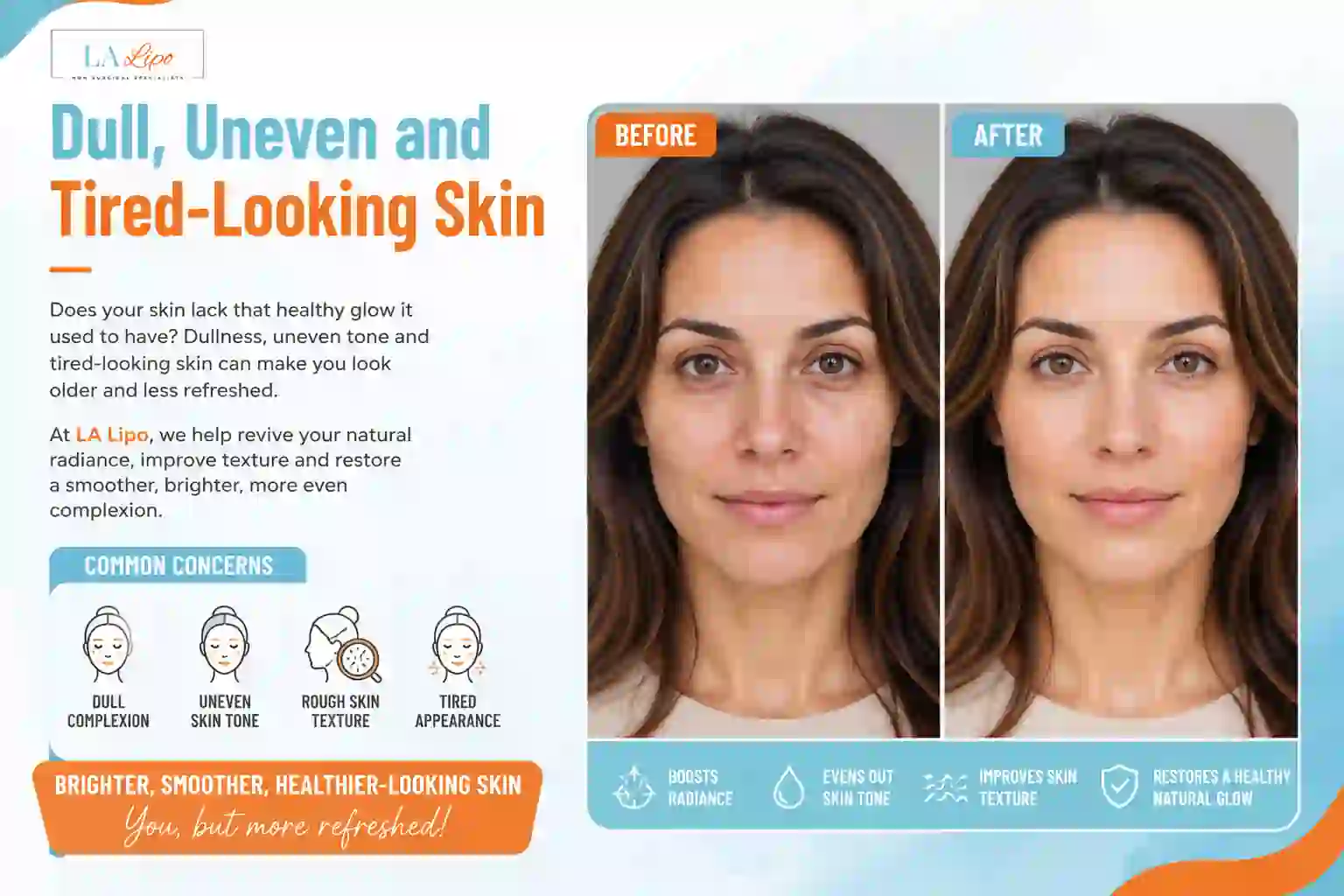 Sign #5: Dull, Uneven and Tired-Looking Skin Northampton