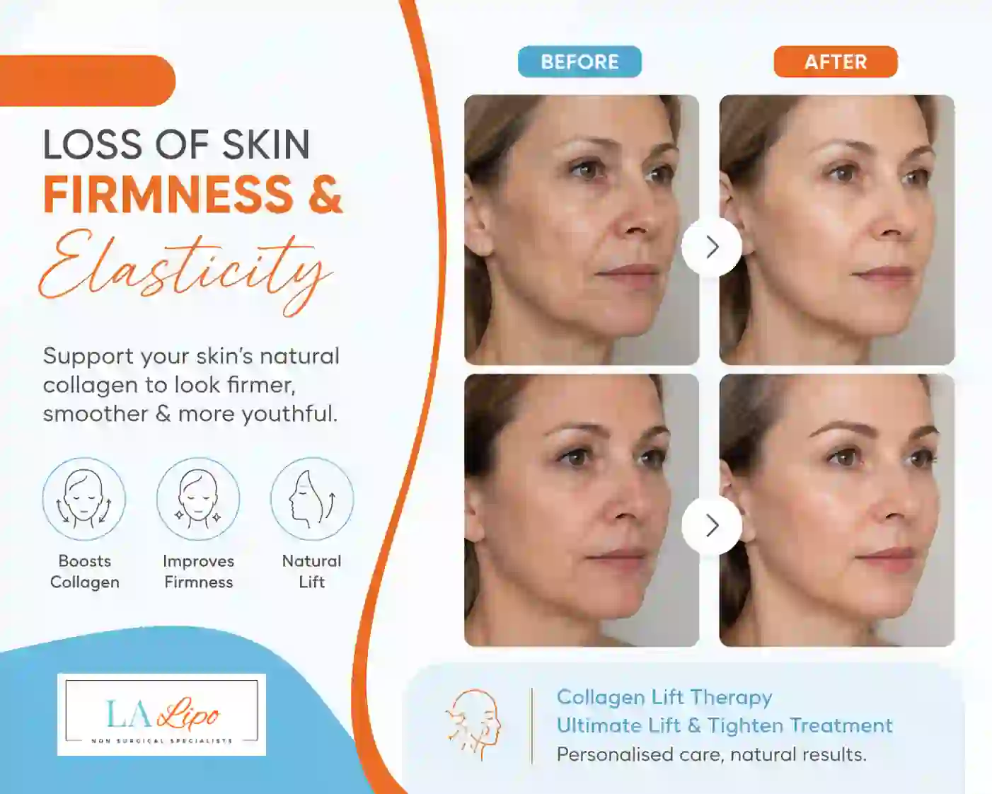 Sign #7: Loss of Skin Firmness and Elasticity Northampton